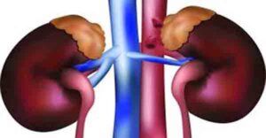 কিডনি রোগীরা যেসব খাবার খাবেন না